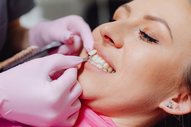 Dental Perfection: The Surprising Truth About Veneers and Your Smile